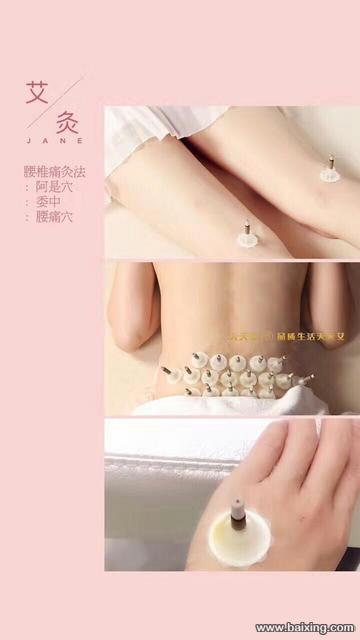 艾灸产品哪种好