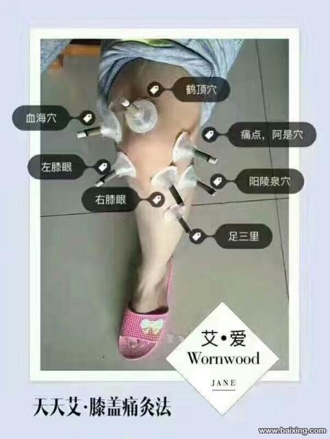 艾灸产品哪种好