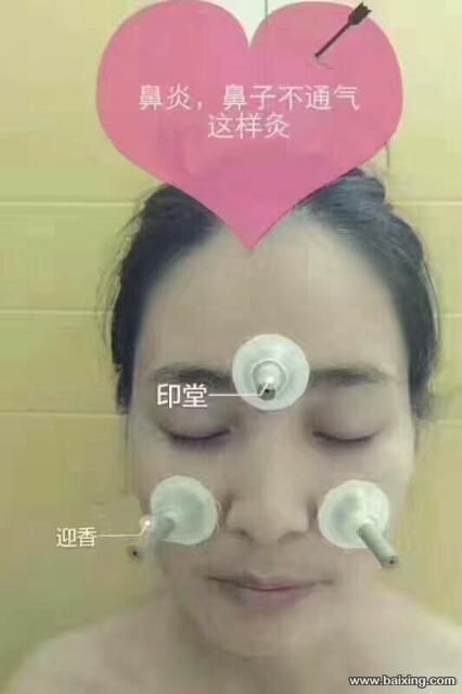 艾灸产品哪种好