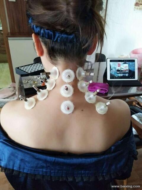 艾灸产品哪种好